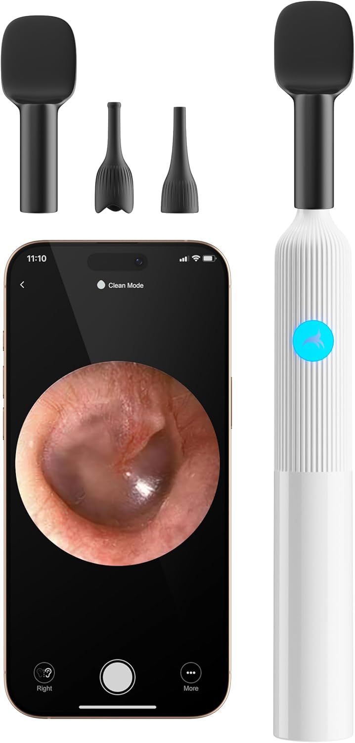 OTTOLIVES Baby Ear Nose Throat Examination Set with HD Camera Home ENT Scope with 6LED Light Ear Checker Tool Baby